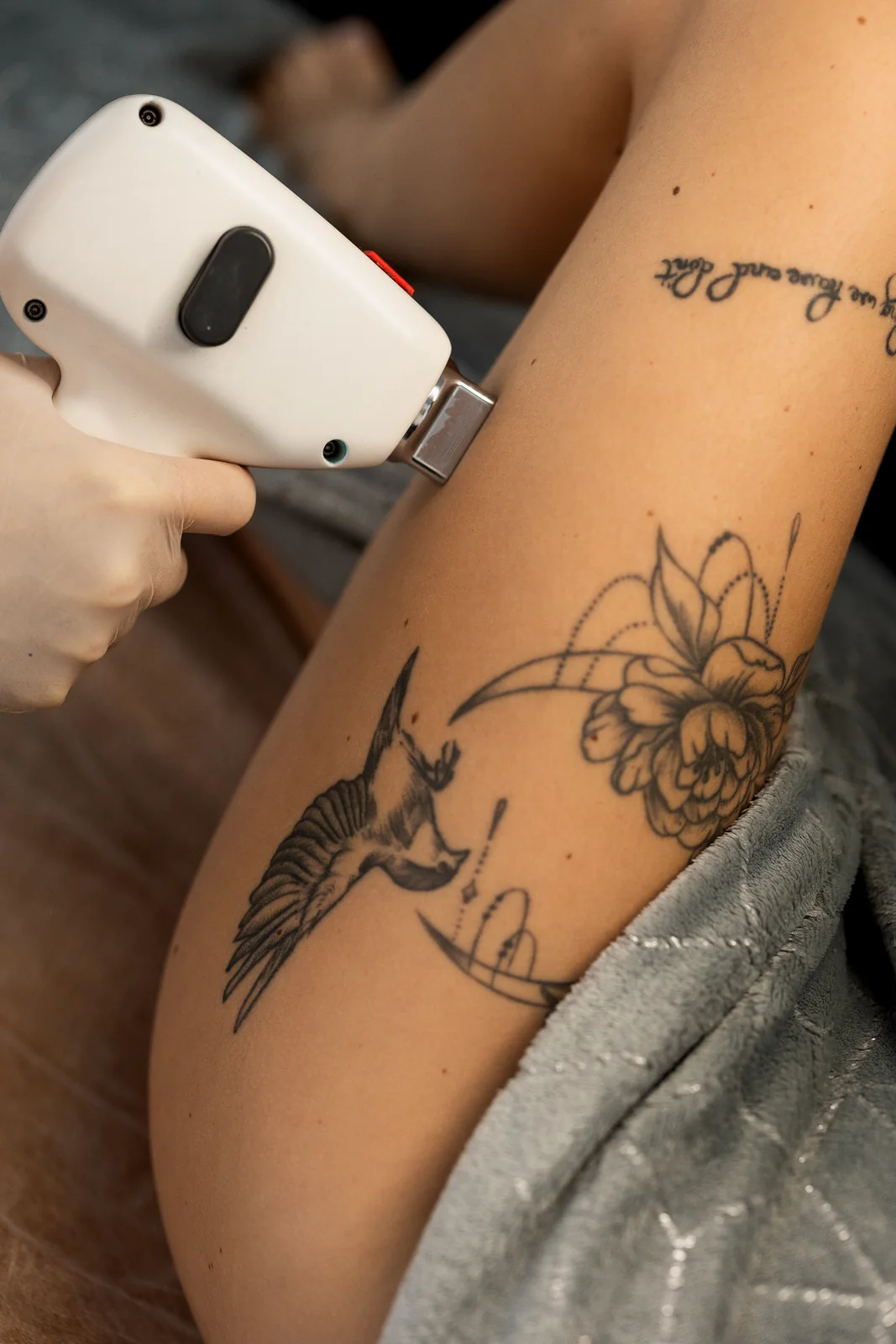 Leaseir laser treatment in detail
